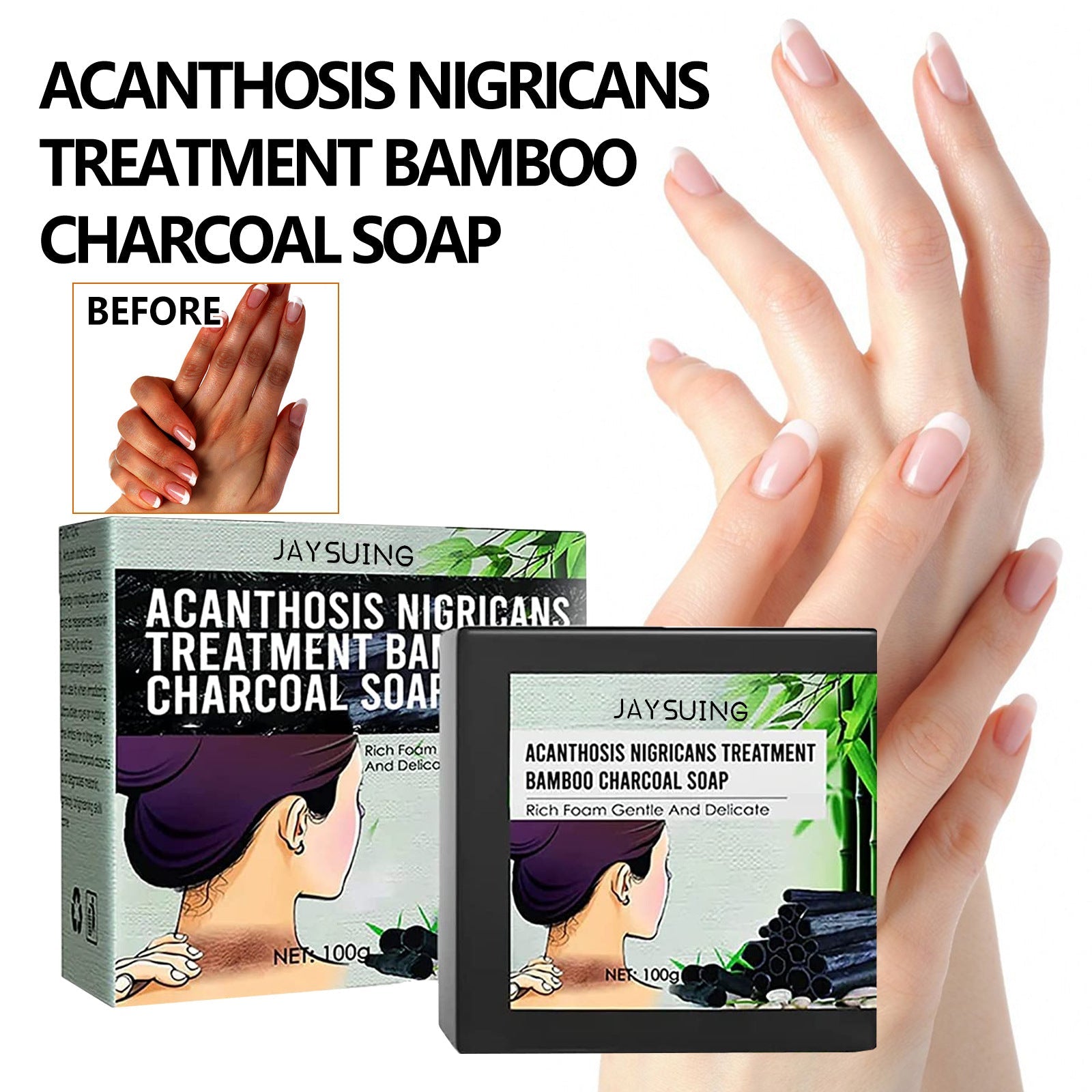 Acanthosis Nigricans Treatment Bamboo Charcoal Soap - Givemethisnow