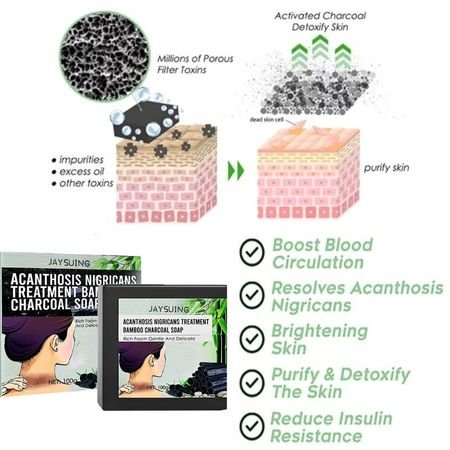 Acanthosis Nigricans Treatment Bamboo Charcoal Soap - Givemethisnow