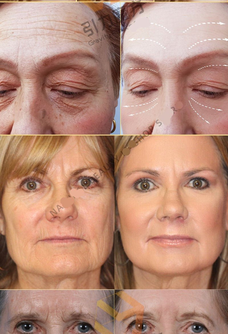 Anti Aging Remove Wrinkle Serum - Givemethisnow