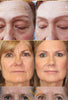 Anti Aging Remove Wrinkle Serum - Givemethisnow