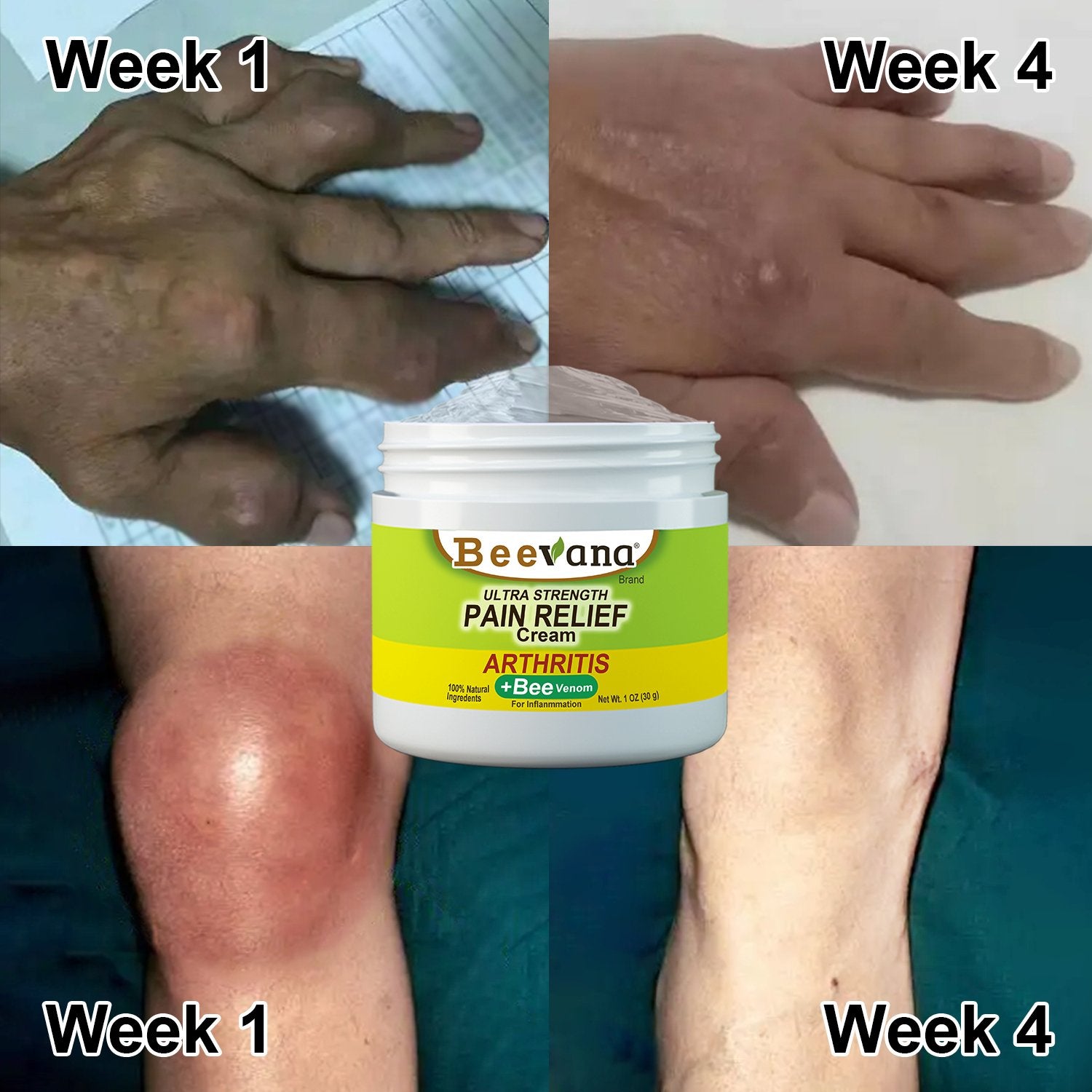 Beevana™ Bee Venom Joint & Bone Therapy Cream (Full Body Recovery, Pure Natural Formula) - Givemethisnow