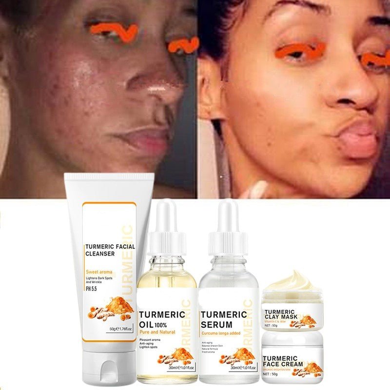 Dark Spot Turmeric Skin Care Set - Givemethisnow