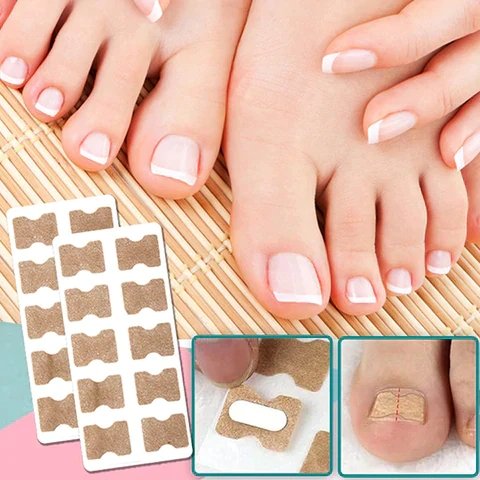 EasyPatches Correction patches for beautiful and healthy nails - Givemethisnow