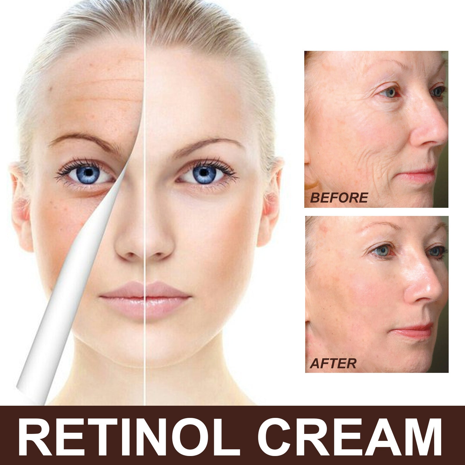 EELHOE Anti Aging Wrinkle Removal Skin Firming Cream - Givemethisnow