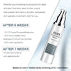 Eelhoe™ Collagen Boost Anti-Aging Serum - Givemethisnow