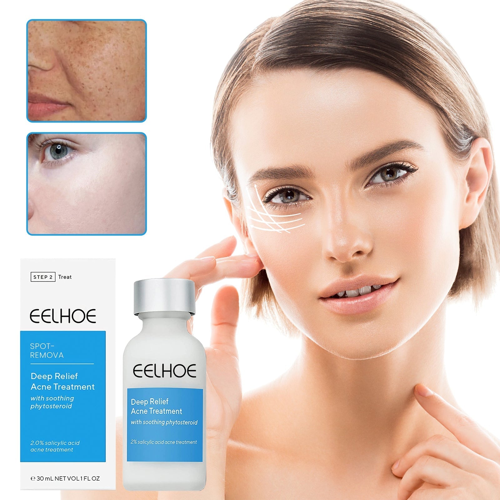 EELHOE™ Dark Spot and Acne Treatment Lotion - Givemethisnow