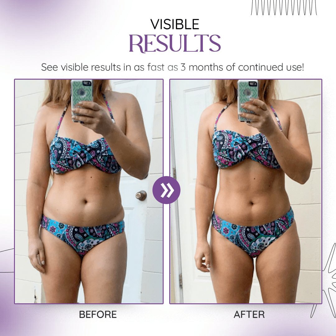 Eelhoi Kenyan Purple Leaves Weight Loss Cream - Givemethisnow