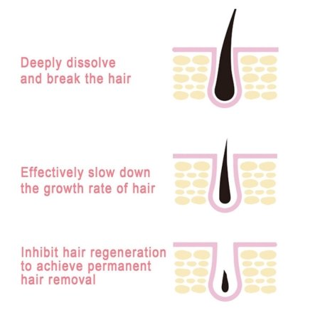 EELHOI Painless Hair Removal Spray - Givemethisnow