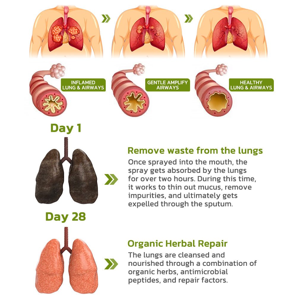 GFOUK™️ BreathDetox Herbal Lung Cleansing Spray - Givemethisnow