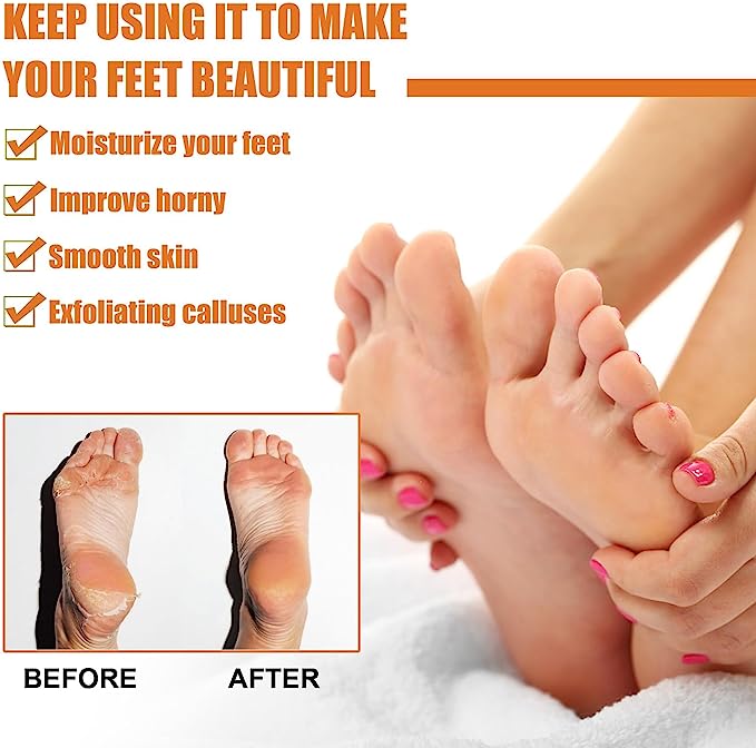 GFOUK™ Foot Callus Removal Spray - Givemethisnow