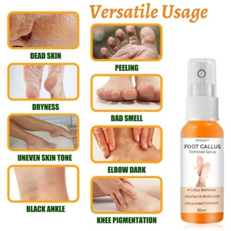 GFOUK™ Foot Callus Removal Spray - Givemethisnow