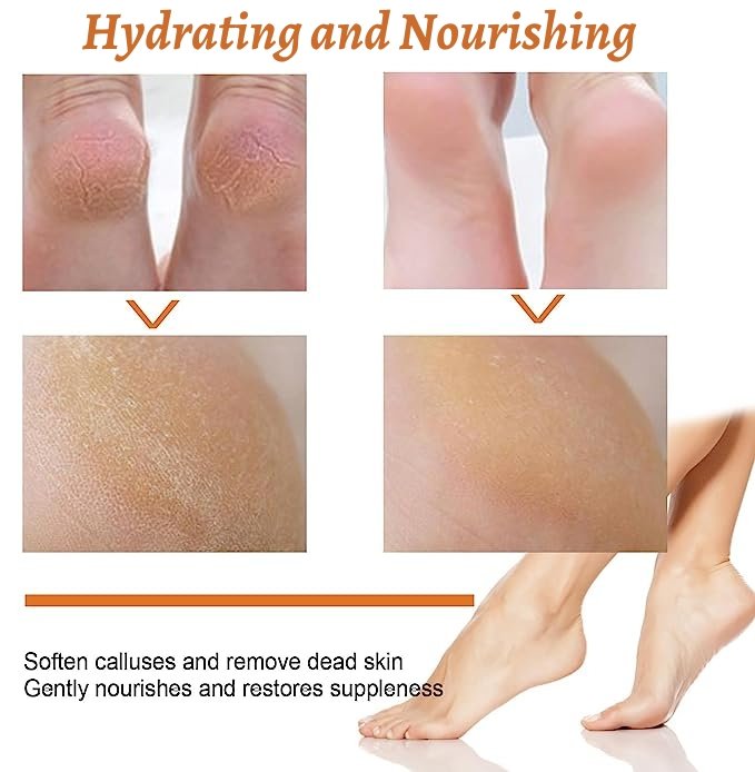 GFOUK™ Foot Callus Removal Spray - Givemethisnow