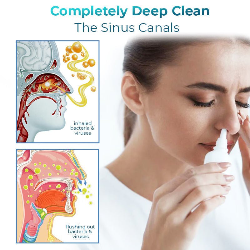 GFOUK™ Nasal Mucus Cleansing Spray - Givemethisnow