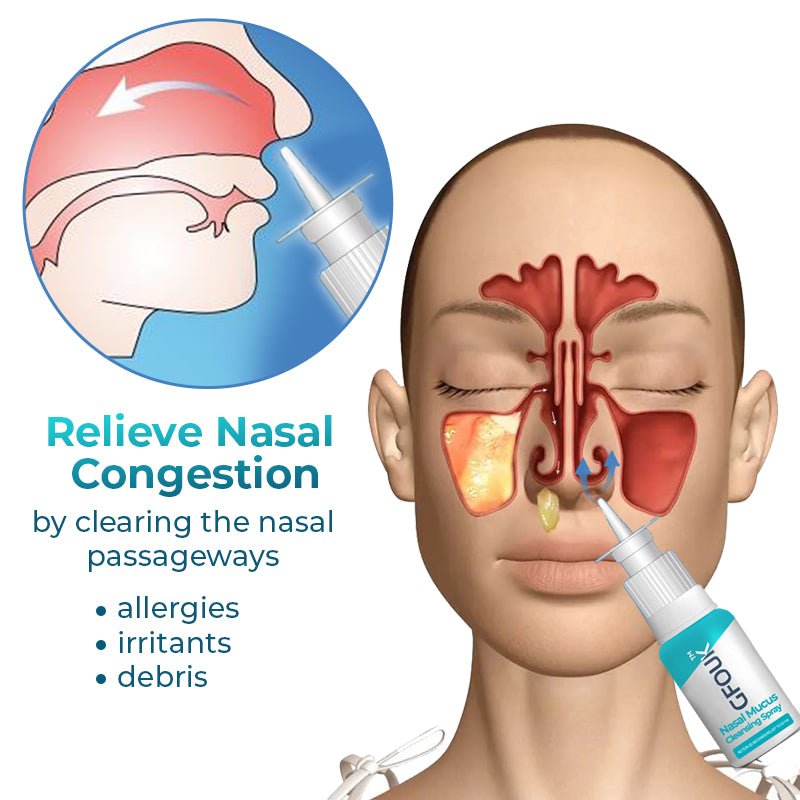 GFOUK™ Nasal Mucus Cleansing Spray - Givemethisnow