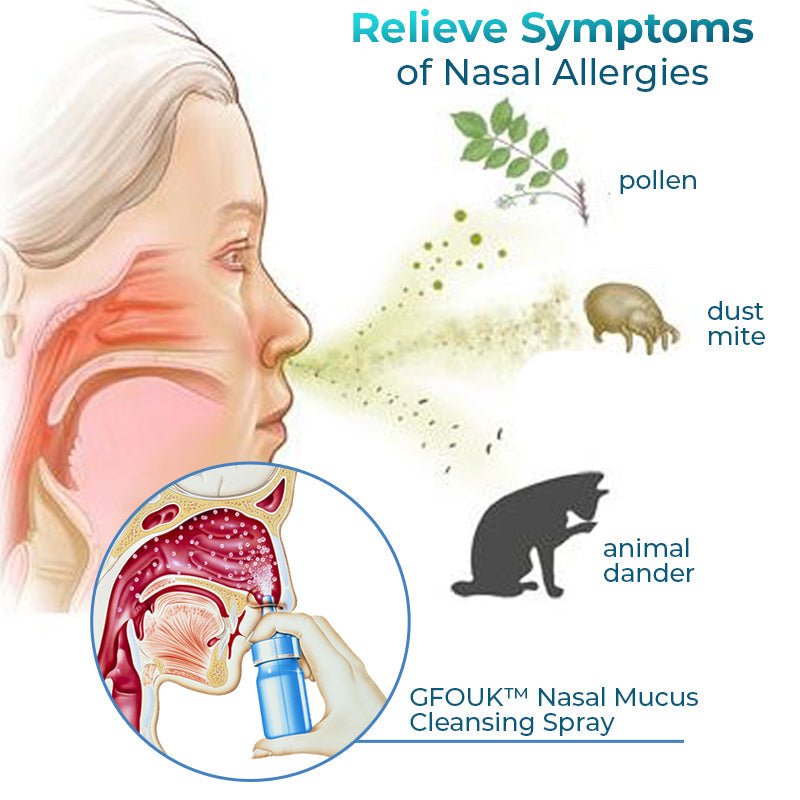 GFOUK™ Nasal Mucus Cleansing Spray - Givemethisnow