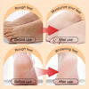 Ginger Foot Peel Mask - Givemethisnow