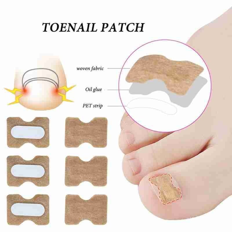 Glue Free Toenail Patch - Givemethisnow