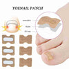 Glue Free Toenail Patch - Givemethisnow