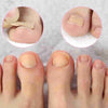 Glue Free Toenail Patch - Givemethisnow