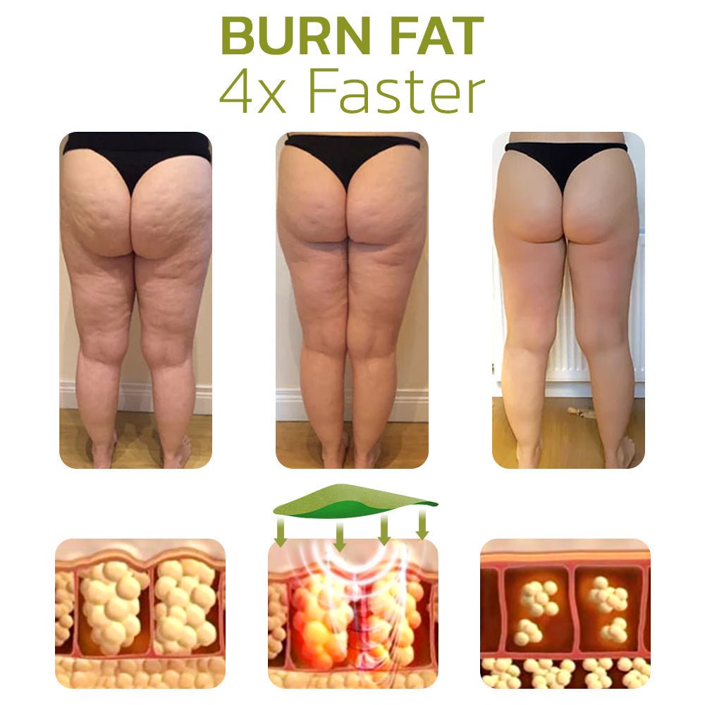 HerbalLegs Cellulite Reduction Patches - Givemethisnow