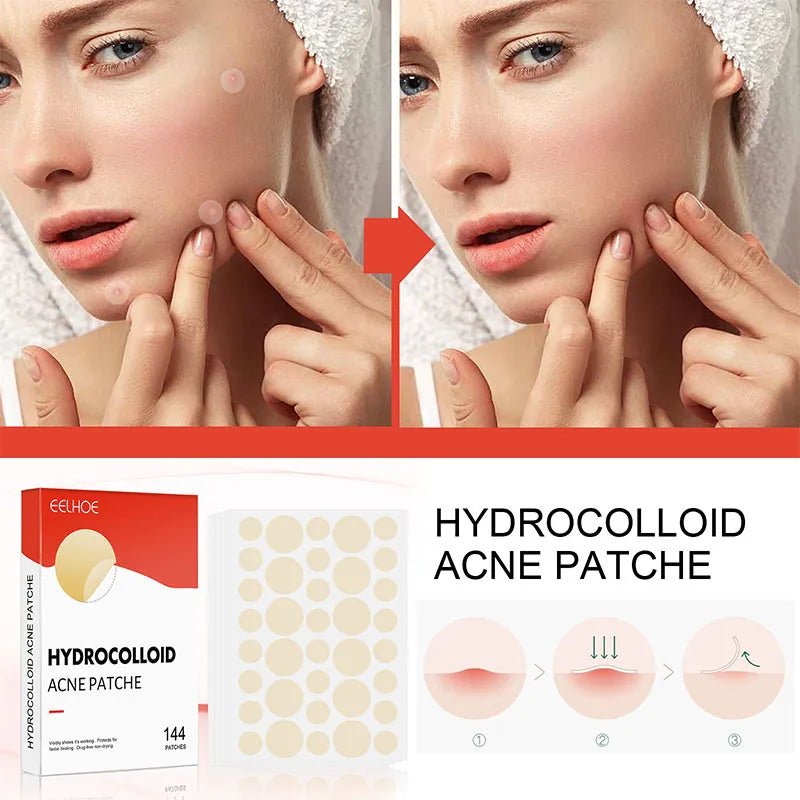 Hydrocolloid Acne Pimple Patch - Givemethisnow