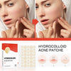 Hydrocolloid Acne Pimple Patch - Givemethisnow