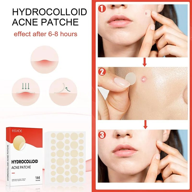 Hydrocolloid Acne Pimple Patch - Givemethisnow