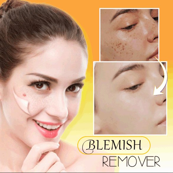 INSTANT ACNE BLEMISH REMOVAL GEL - Givemethisnow