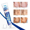 Instant Blemish Removal Gel - Givemethisnow