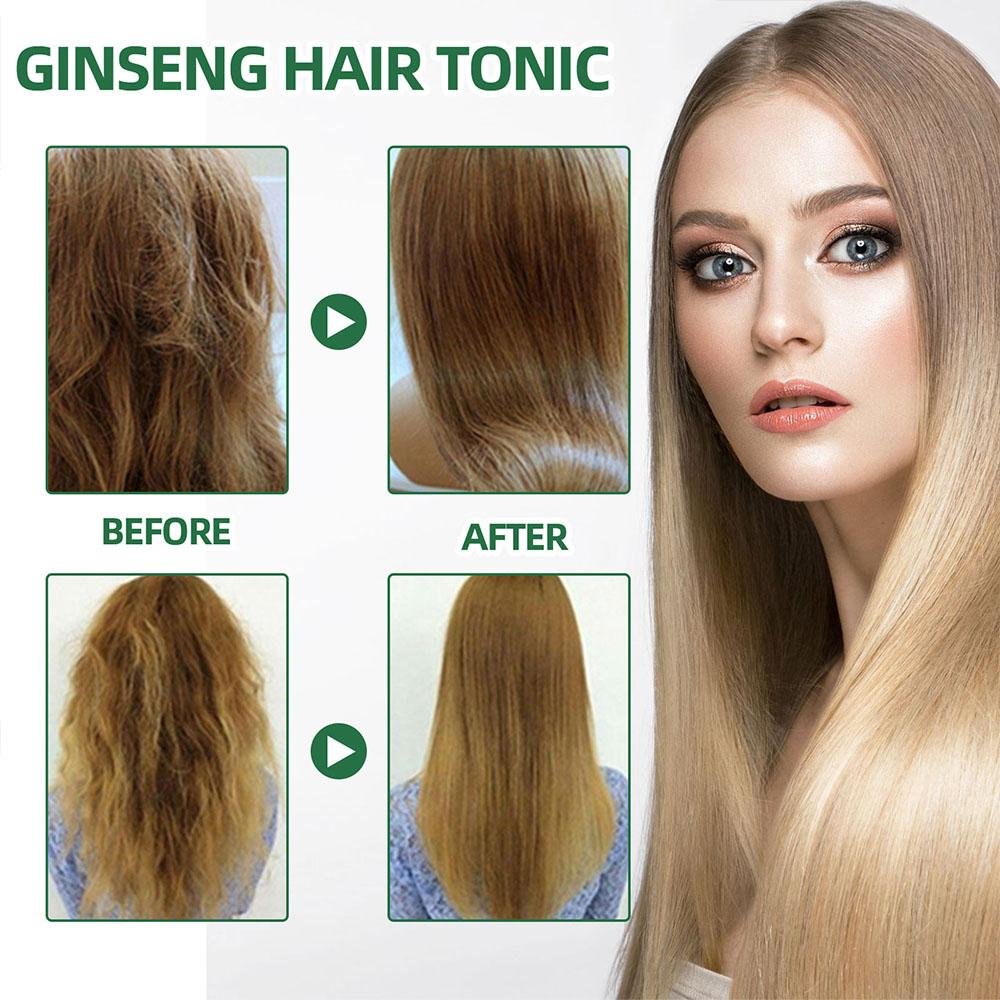 OUHOE HairRegen RedGinseng Spray - Givemethisnow