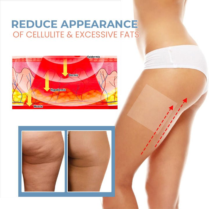 Oveallgo™ PRO TightenCell Anti-Cellulite Collagen Firming Patches - Givemethisnow