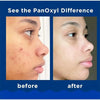 PanOxyl Acne Foaming Wash - Givemethisnow