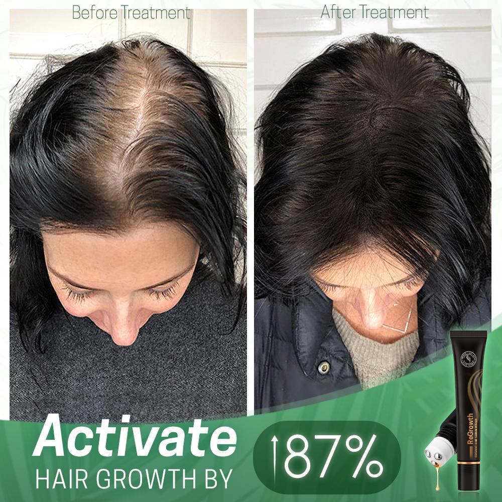 Regrowth Organic Hair Serum Roller - Givemethisnow