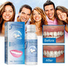 SmileSaver - Tooth Repair Beads - Givemethisnow