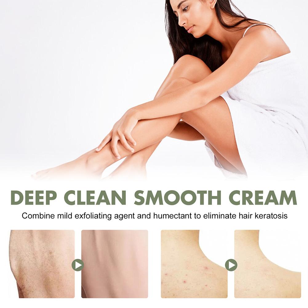 South Moon KeratosisTreat Deep Clean Smooth Cream - Givemethisnow