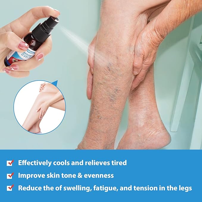 South Moon Varicose Vein Spray - Givemethisnow