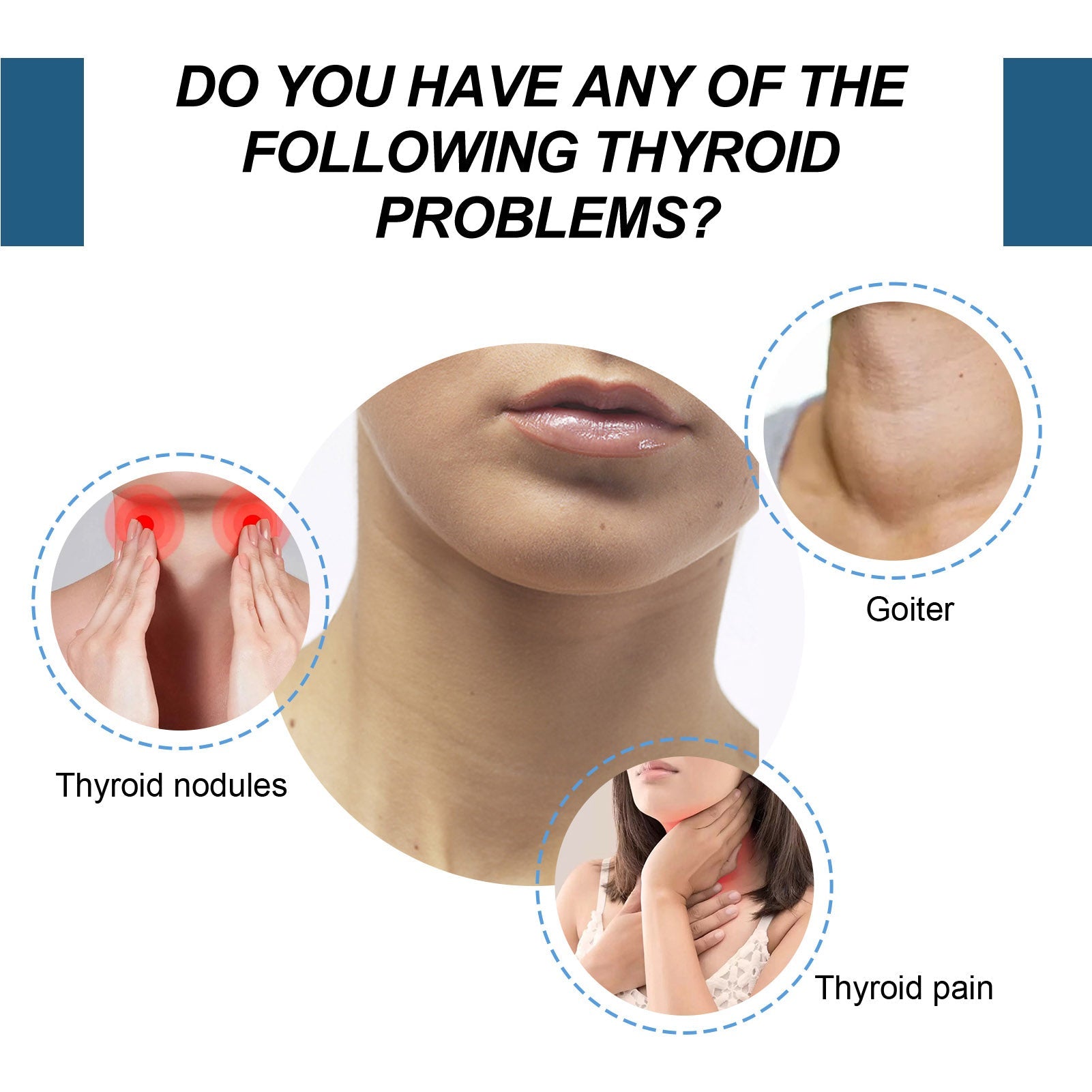 Thyroid Gland Lymph Nodes Patches - Givemethisnow