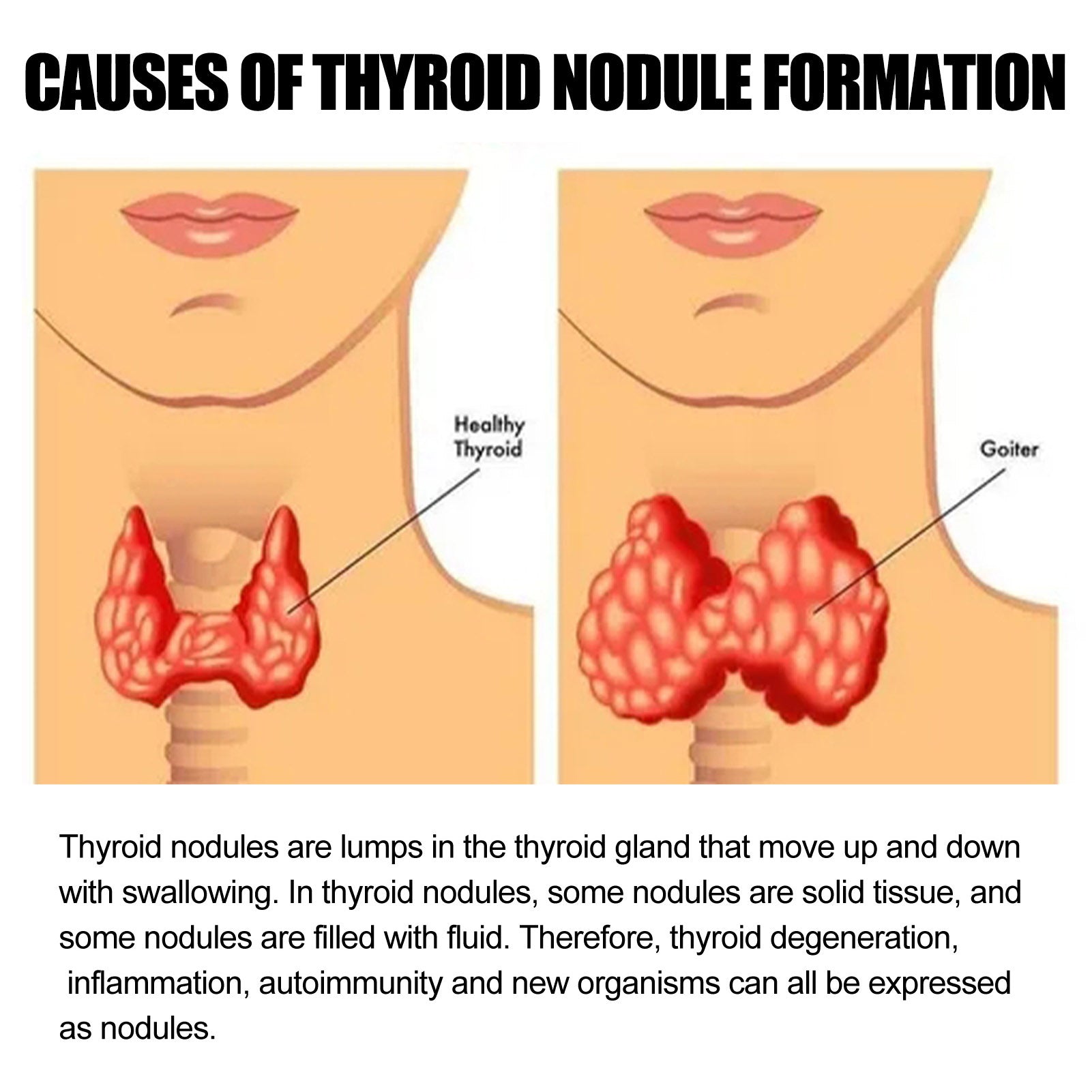 Thyroid Gland Lymph Nodes Patches - Givemethisnow