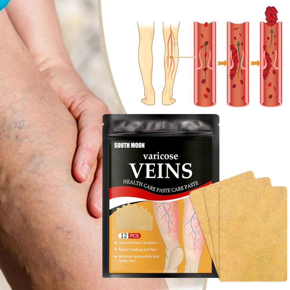 Varicose Veins Healing Patch - Givemethisnow