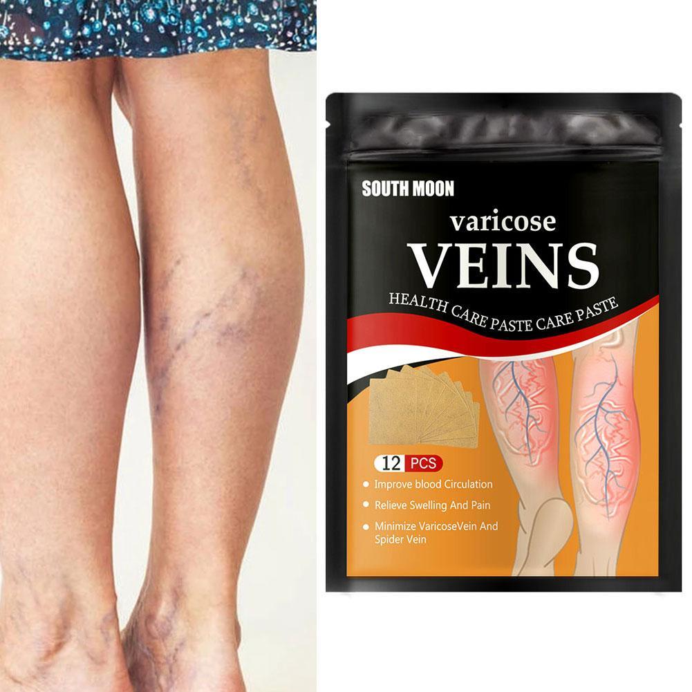 Varicose Veins Healing Patch - Givemethisnow