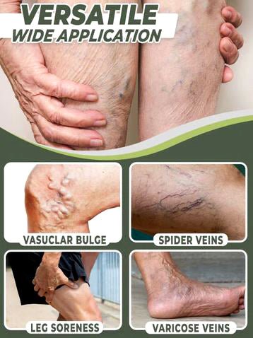 Varicose Veins Healing Patch - Givemethisnow