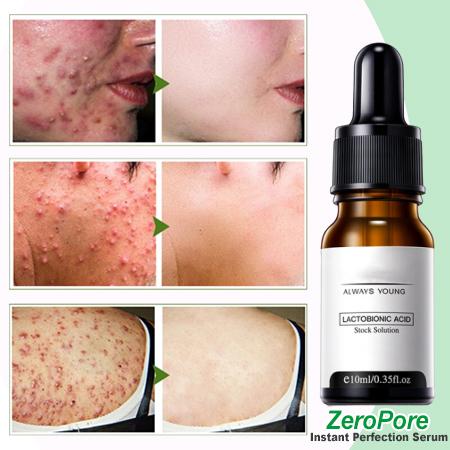 ZeroPore Instant Perfection Serum - Givemethisnow