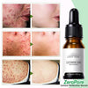 ZeroPore Instant Perfection Serum - Givemethisnow